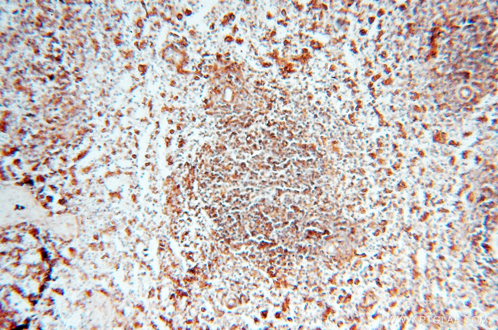 Immunohistochemistry (IHC) staining of human spleen tissue using Beta Actin Monoclonal antibody (60008-1-Ig)