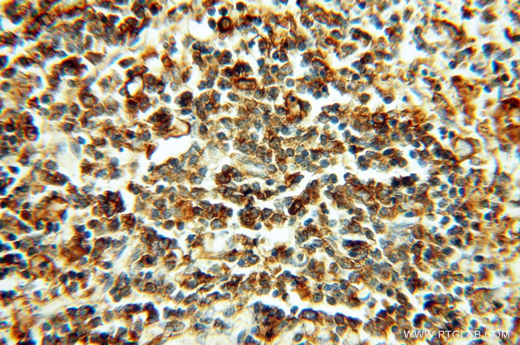 Immunohistochemistry (IHC) staining of human spleen tissue using Beta Actin Monoclonal antibody (60008-1-Ig)