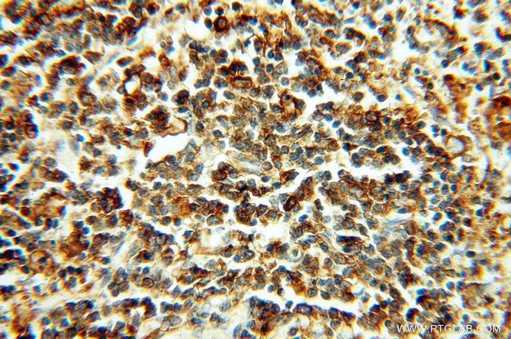 IHC staining of human spleen using 60008-1-Ig