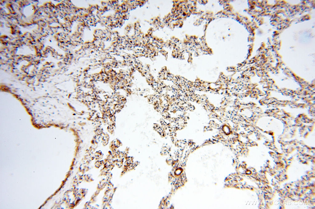 Immunohistochemistry (IHC) staining of human lung tissue using Beta Actin Monoclonal antibody (60008-1-Ig)