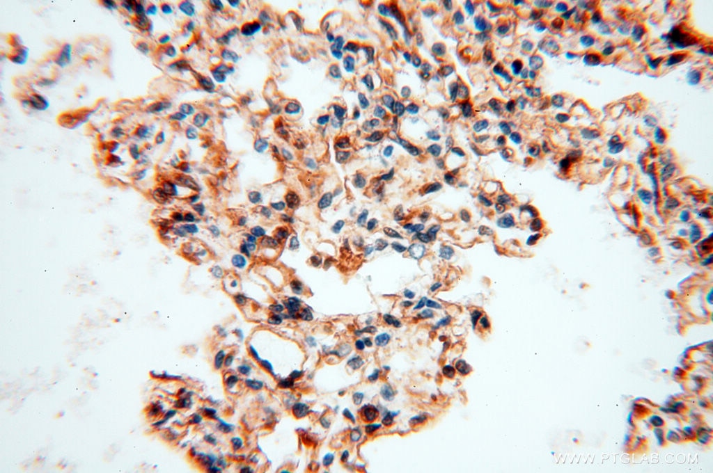 Immunohistochemistry (IHC) staining of human lung tissue using Beta Actin Monoclonal antibody (60008-1-Ig)