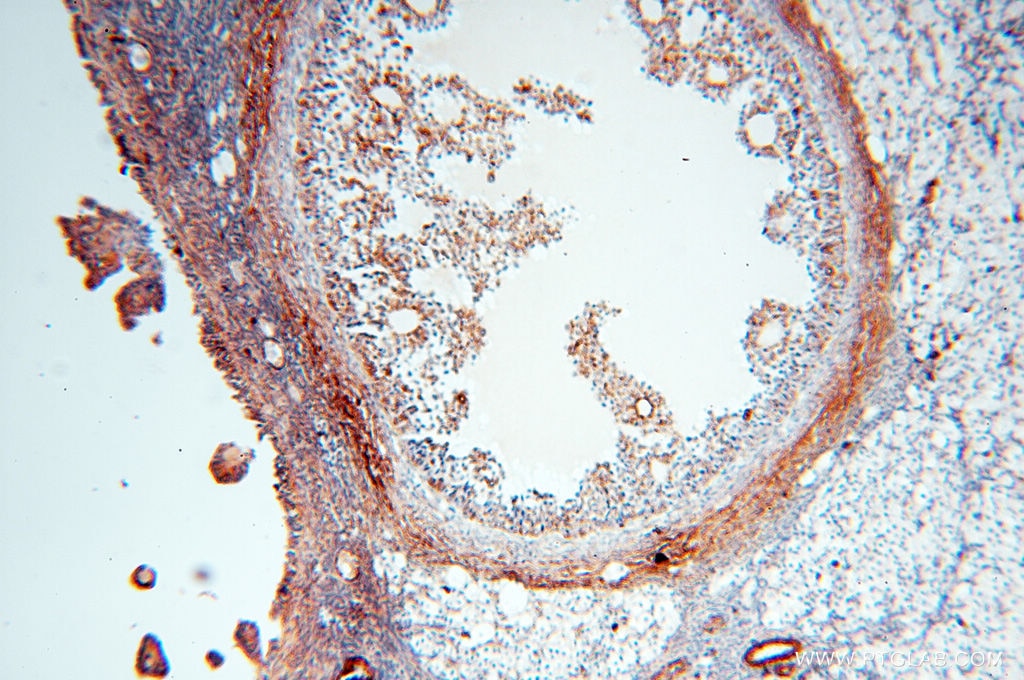 IHC staining of human ovary using 60008-1-Ig