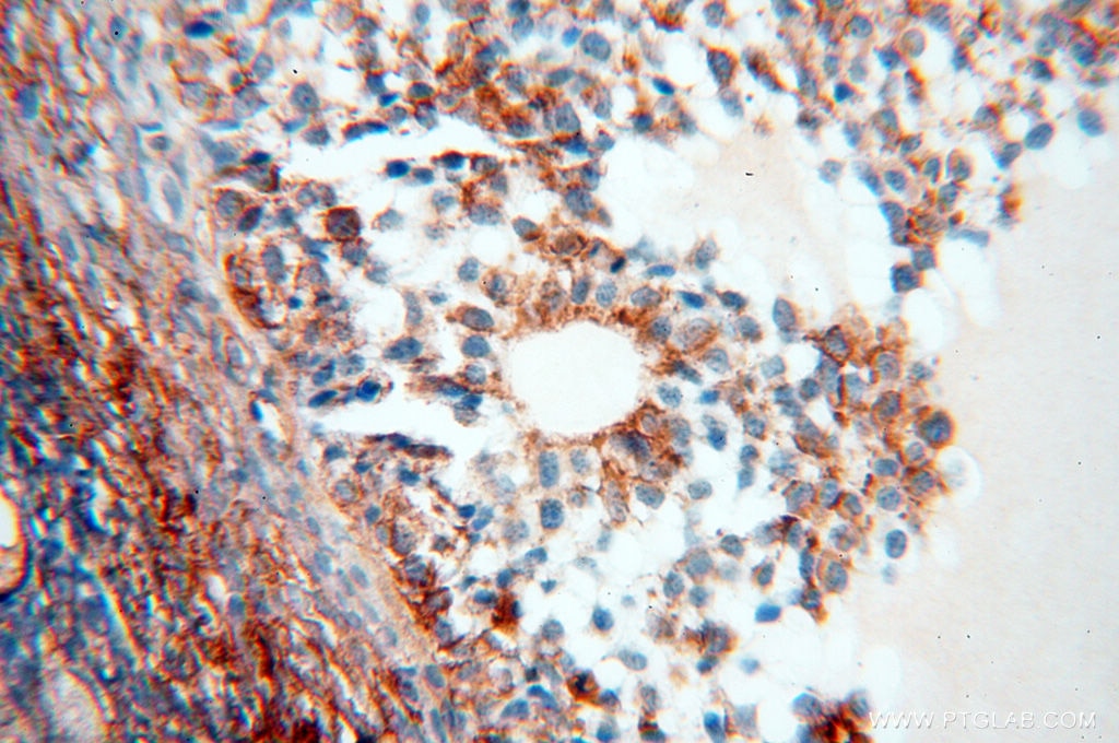 Immunohistochemistry (IHC) staining of human ovary tissue using Beta Actin Monoclonal antibody (60008-1-Ig)