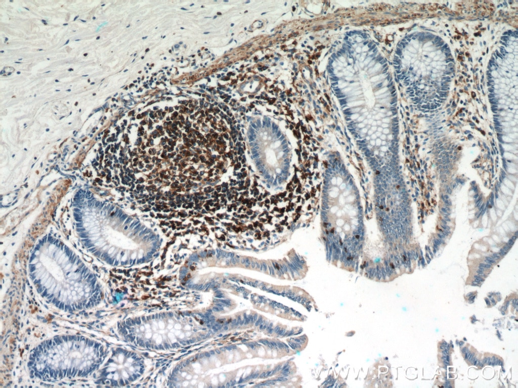 Immunohistochemistry (IHC) staining of human colon tissue using Beta Actin Monoclonal antibody (60008-1-Ig)