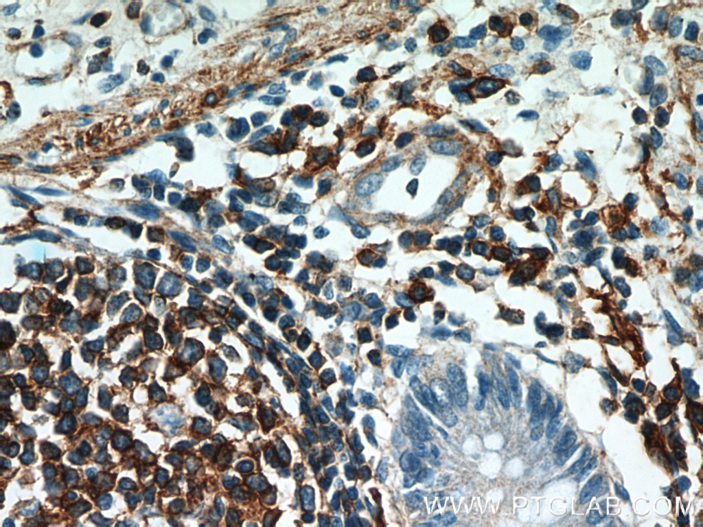 Immunohistochemistry (IHC) staining of human colon tissue using Beta Actin Monoclonal antibody (60008-1-Ig)