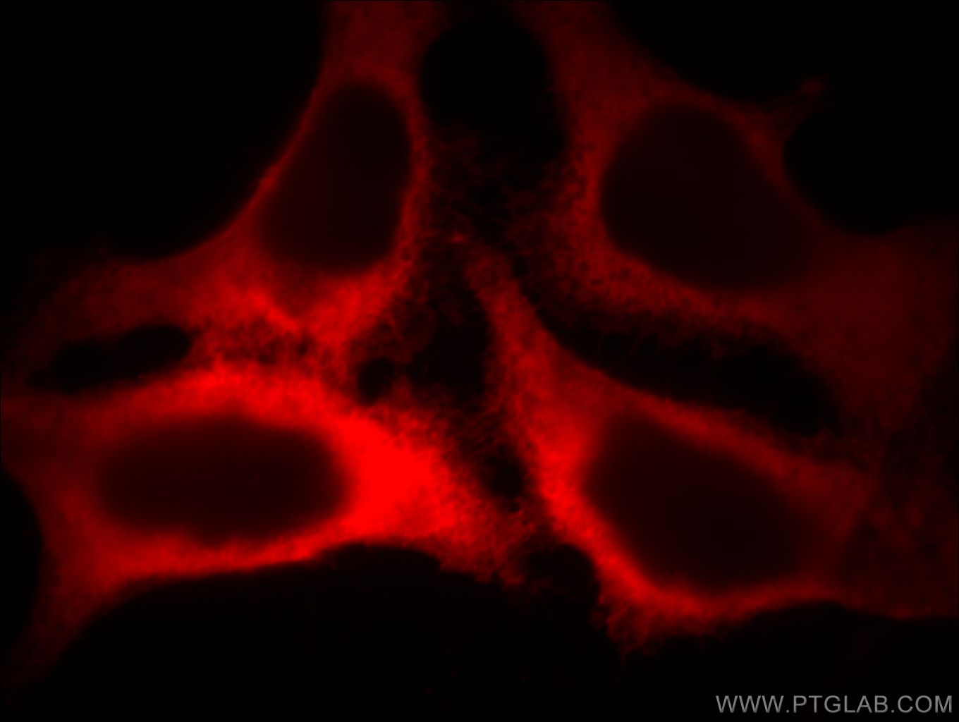 IF Staining of MCF-7 using 60008-2-Ig