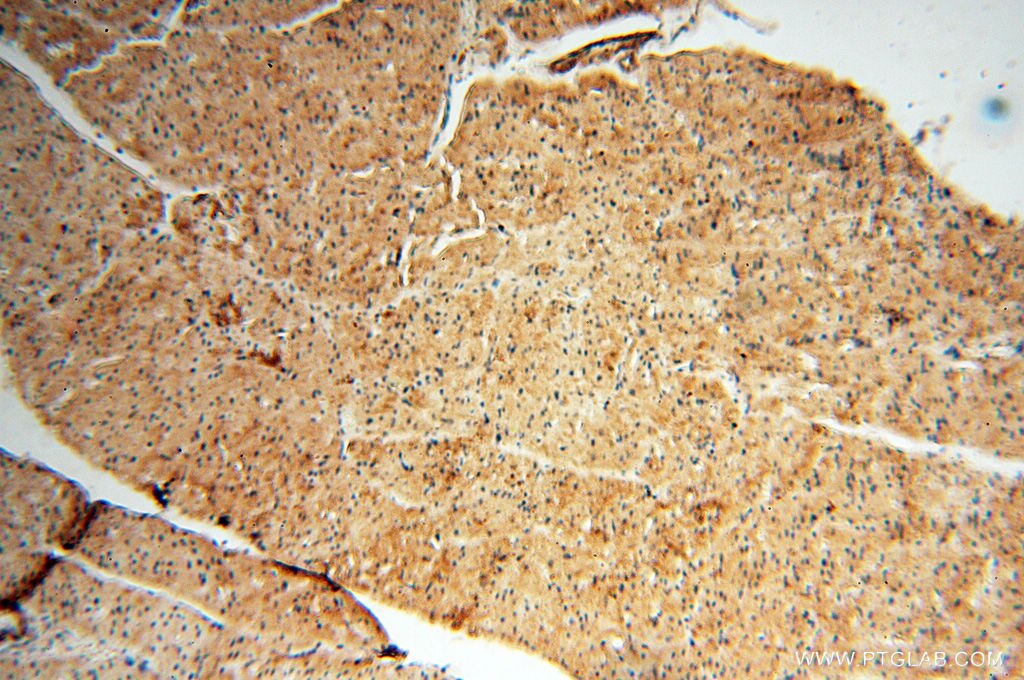 Immunohistochemistry (IHC) staining of human heart tissue using Beta Actin Monoclonal antibody (60008-2-Ig)