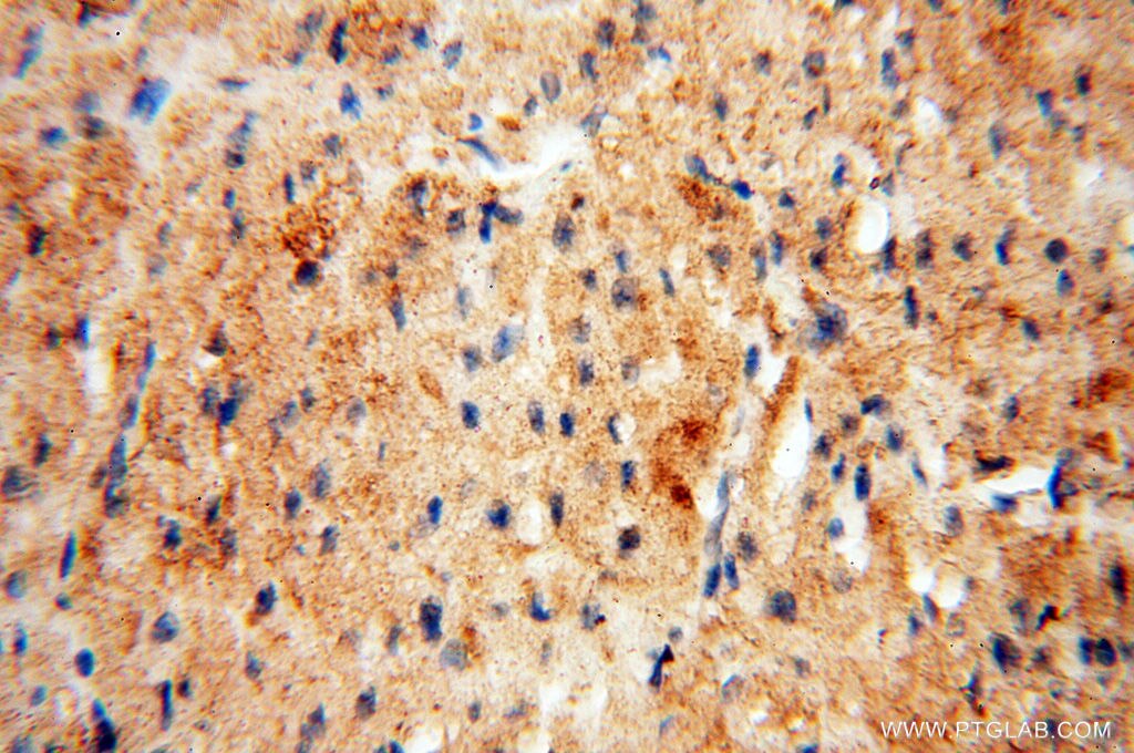 Immunohistochemistry (IHC) staining of human heart tissue using Beta Actin Monoclonal antibody (60008-2-Ig)