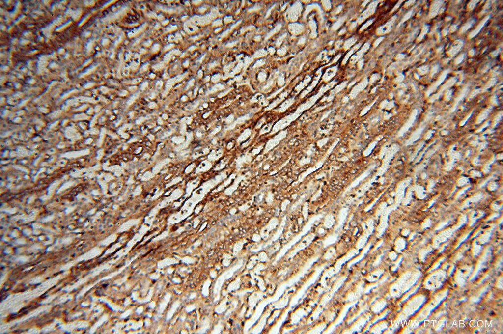 Immunohistochemistry (IHC) staining of human kidney tissue using Beta Actin Monoclonal antibody (60008-2-Ig)