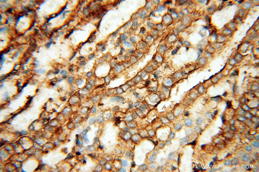 Immunohistochemistry (IHC) staining of human kidney tissue using Beta Actin Monoclonal antibody (60008-2-Ig)