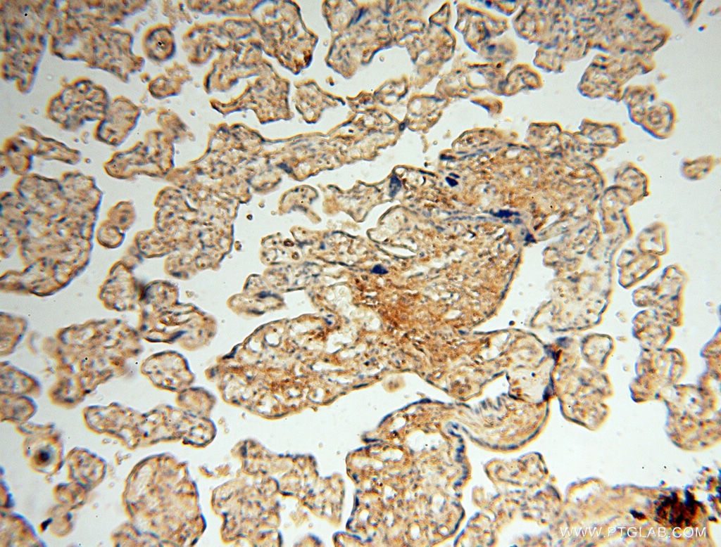 Immunohistochemistry (IHC) staining of human placenta tissue using Beta Actin Monoclonal antibody (60008-2-Ig)