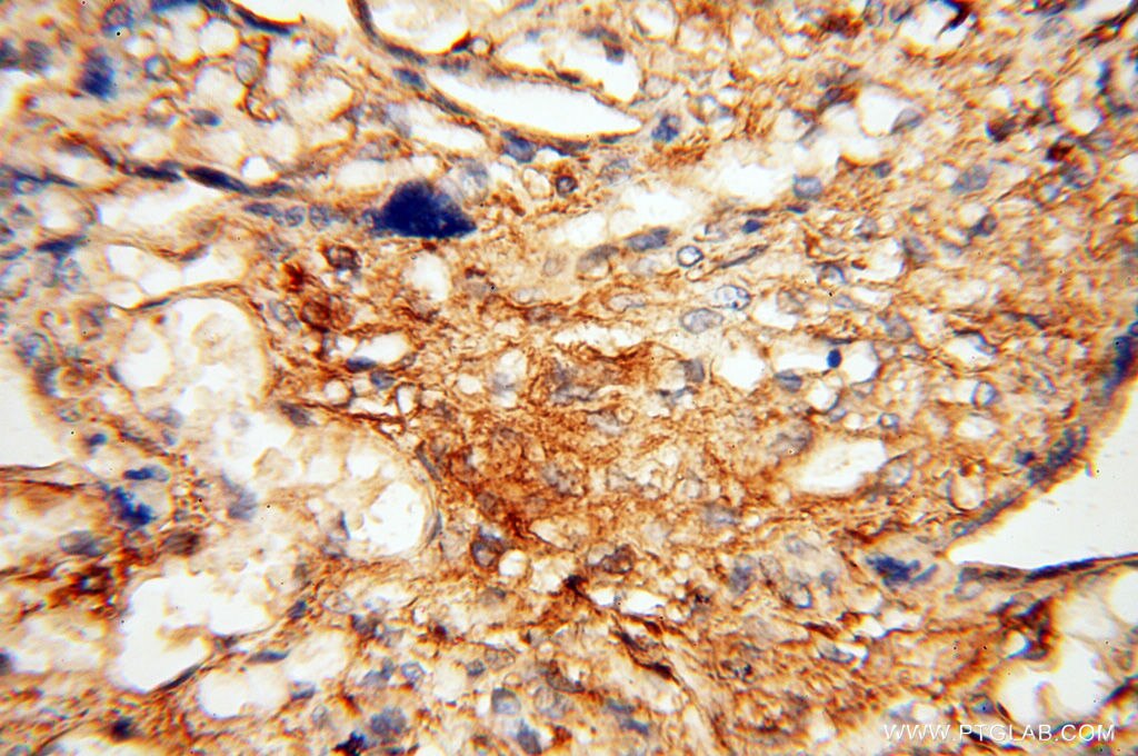 Immunohistochemistry (IHC) staining of human placenta tissue using Beta Actin Monoclonal antibody (60008-2-Ig)