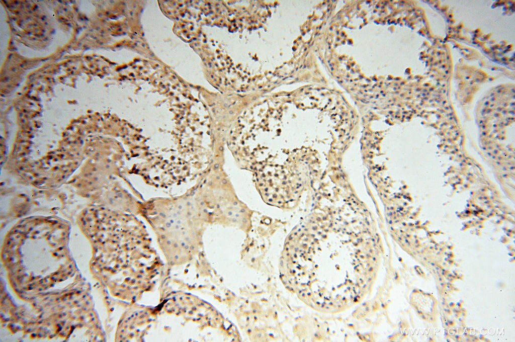 IHC staining of human testis using 60008-2-Ig