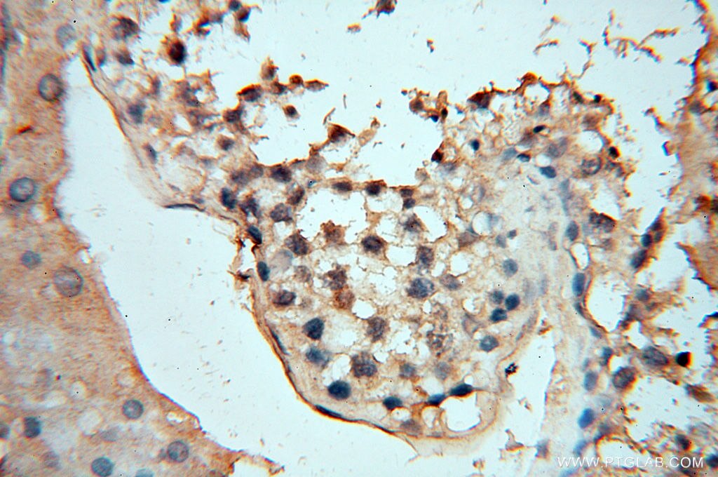 Immunohistochemistry (IHC) staining of human testis tissue using Beta Actin Monoclonal antibody (60008-2-Ig)