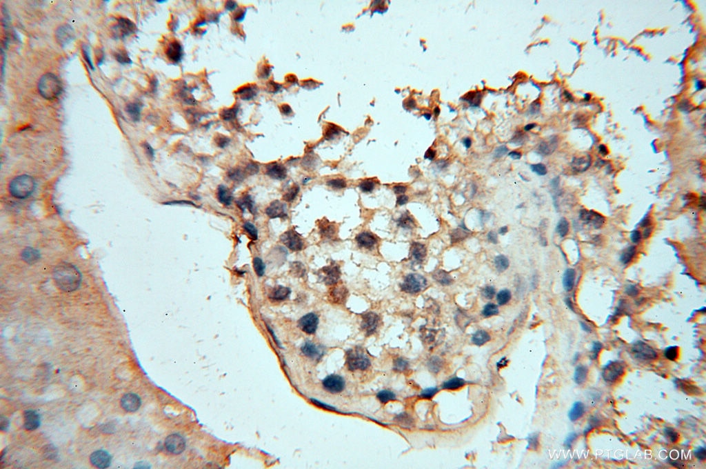 IHC staining of human testis using 60008-2-Ig