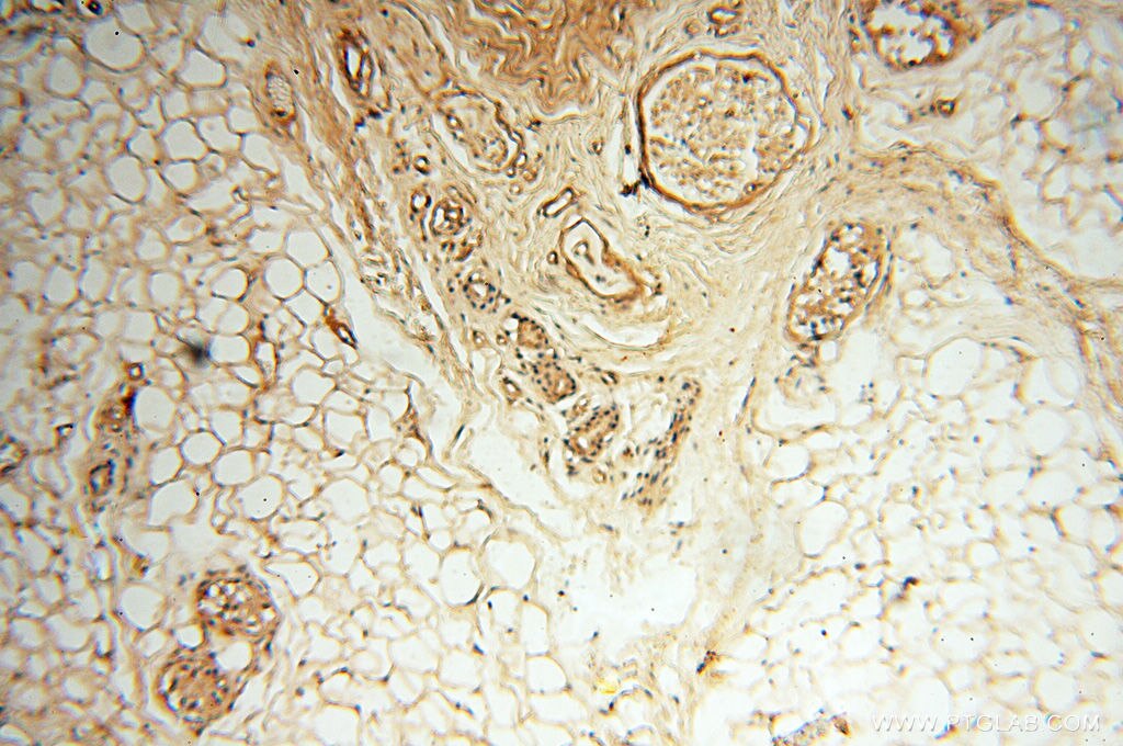 Immunohistochemistry (IHC) staining of human skin tissue using Beta Actin Monoclonal antibody (60008-2-Ig)