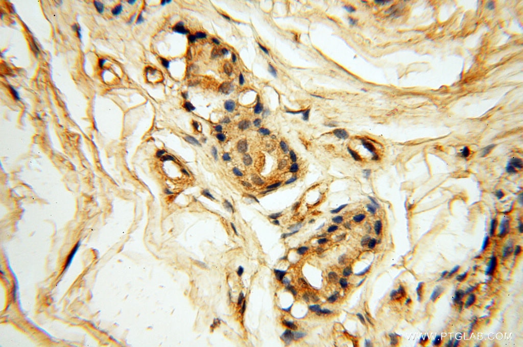 Immunohistochemistry (IHC) staining of human skin tissue using Beta Actin Monoclonal antibody (60008-2-Ig)