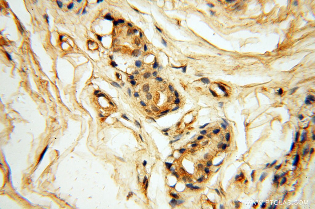 IHC staining of human skin using 60008-2-Ig