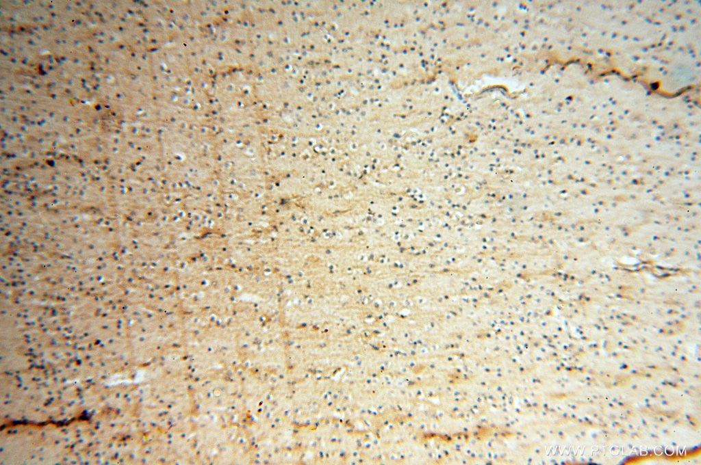 Immunohistochemistry (IHC) staining of human brain tissue using Beta Actin Monoclonal antibody (60008-2-Ig)