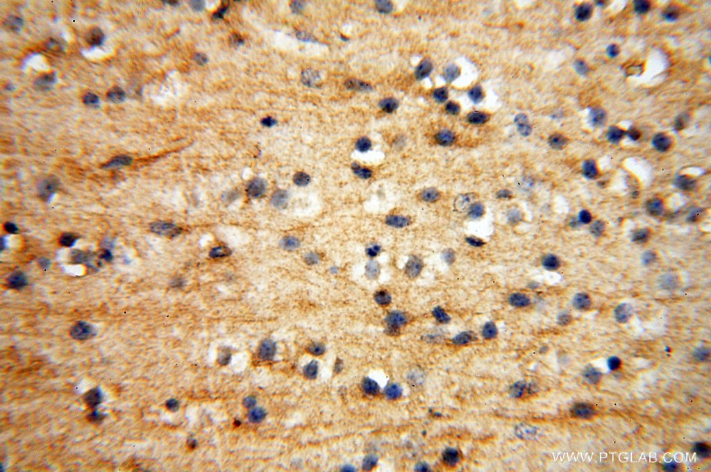 Immunohistochemistry (IHC) staining of human brain tissue using Beta Actin Monoclonal antibody (60008-2-Ig)