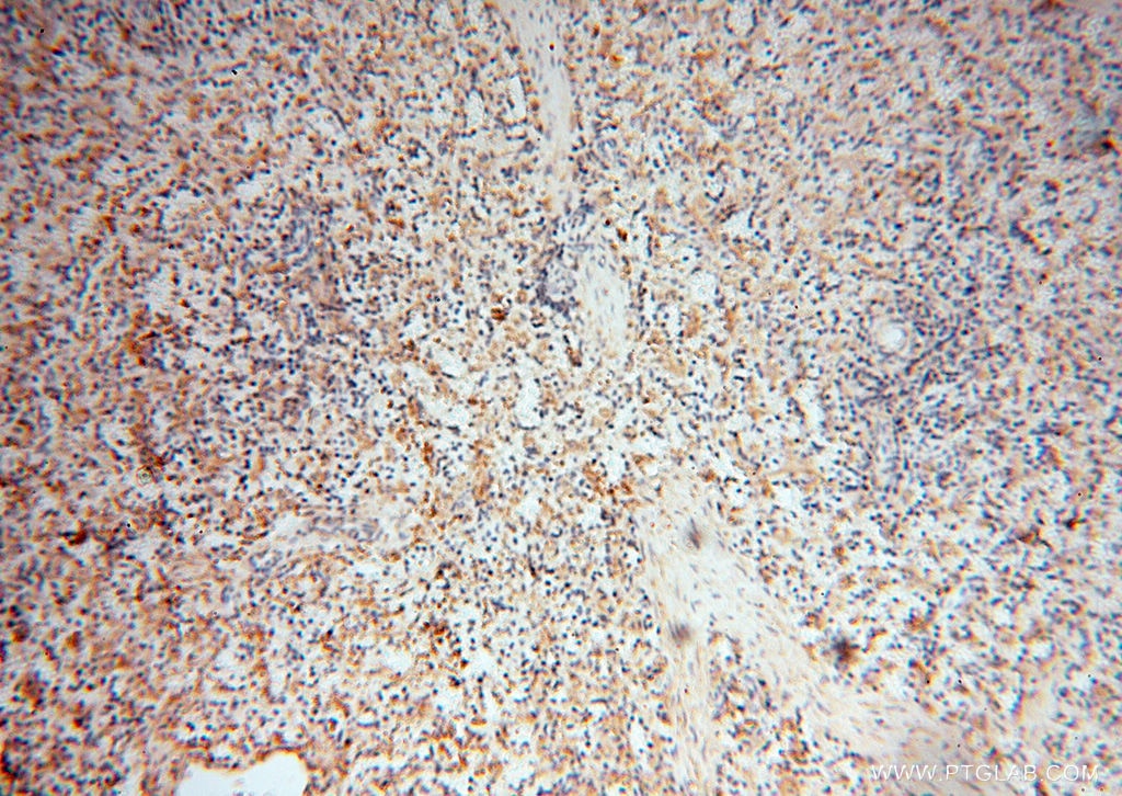 IHC staining of human spleen using 60008-2-Ig