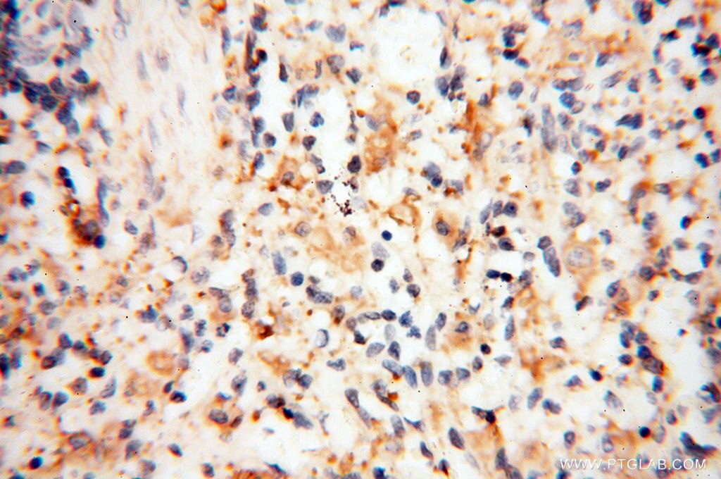 Immunohistochemistry (IHC) staining of human spleen tissue using Beta Actin Monoclonal antibody (60008-2-Ig)