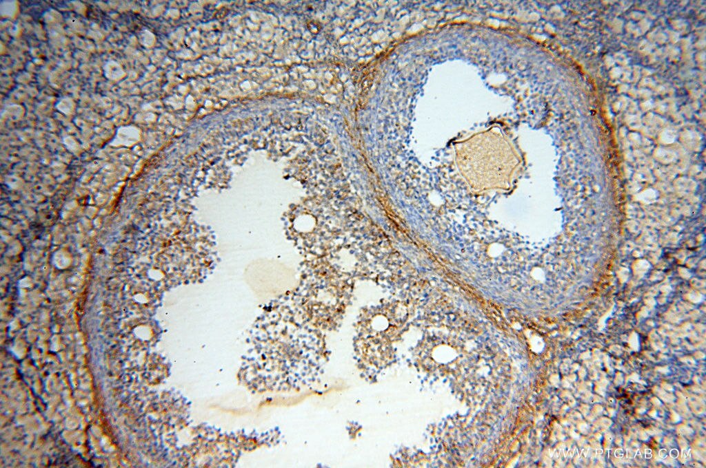 Immunohistochemistry (IHC) staining of human ovary tissue using Beta Actin Monoclonal antibody (60008-2-Ig)