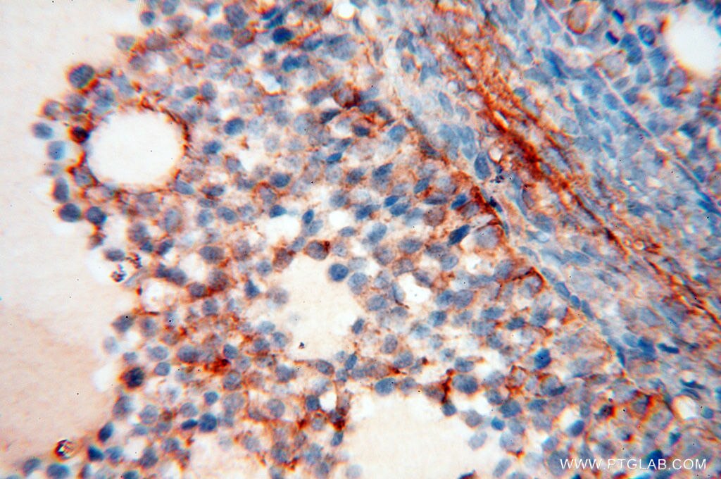 Immunohistochemistry (IHC) staining of human ovary tissue using Beta Actin Monoclonal antibody (60008-2-Ig)