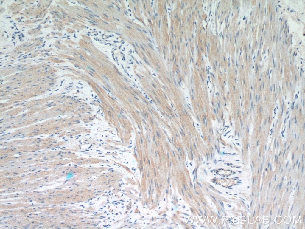 Immunohistochemistry (IHC) staining of human colon tissue using Beta Actin Monoclonal antibody (60008-2-Ig)