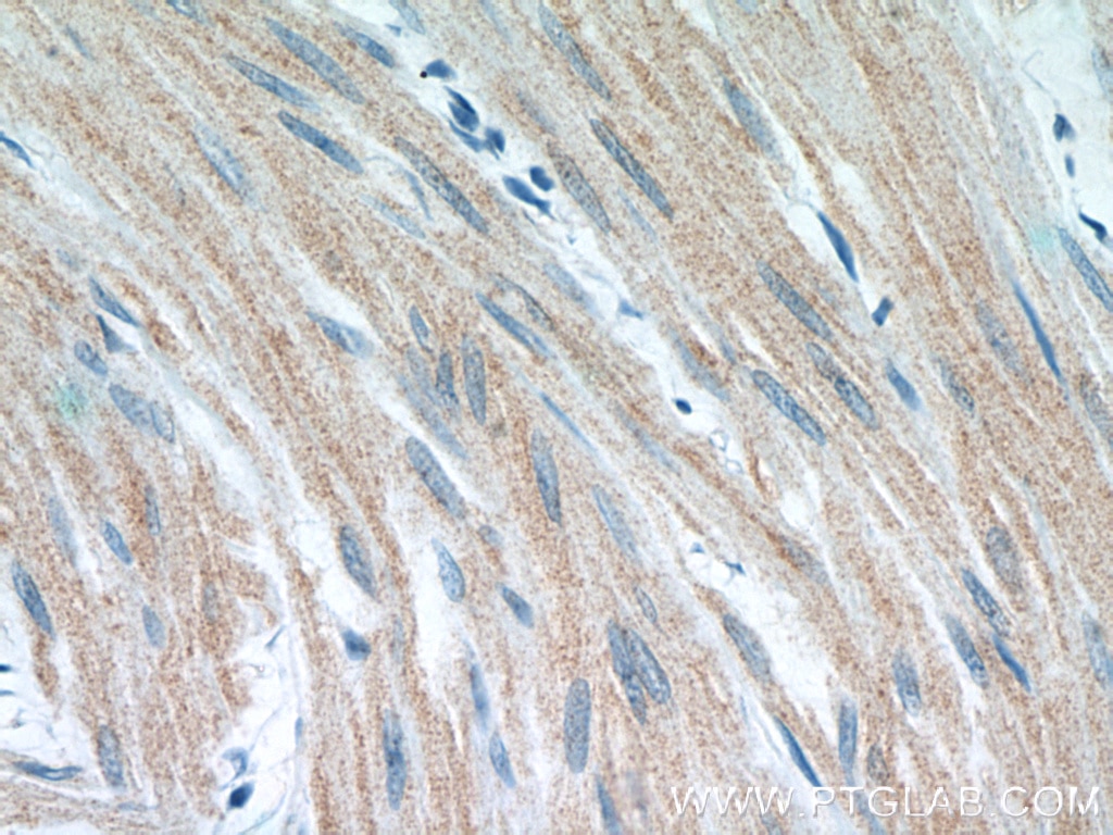 Immunohistochemistry (IHC) staining of human colon tissue using Beta Actin Monoclonal antibody (60008-2-Ig)
