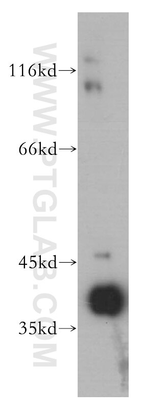 Western Blot (WB) analysis of HeLa cells using Beta Actin Monoclonal antibody (60008-2-Ig)