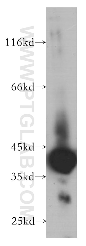 Western Blot (WB) analysis of HEK-293 cells using Beta Actin Monoclonal antibody (60008-2-Ig)