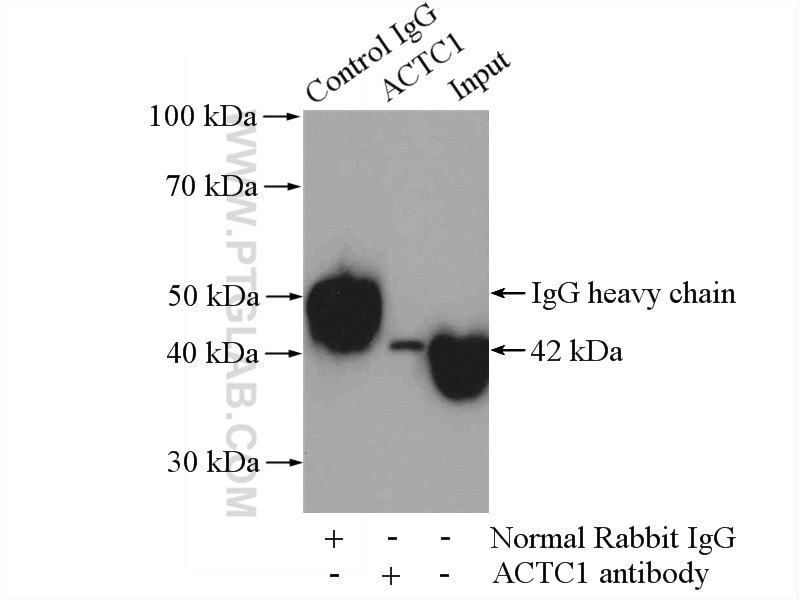 Immunoprecipitation (IP) experiment of mouse heart tissue using Alpha Actin Polyclonal antibody (11032-1-AP)
