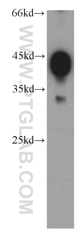 Western Blot (WB) analysis of mouse skeletal muscle tissue using Alpha Actin Polyclonal antibody (11032-1-AP)