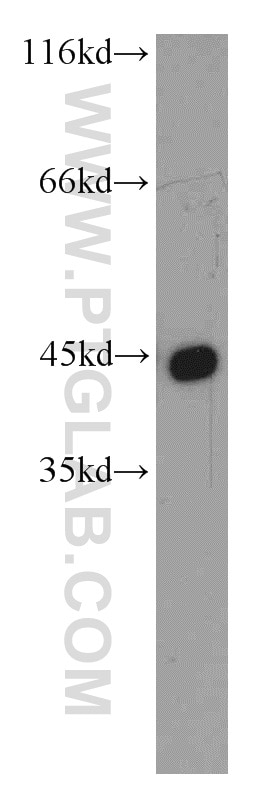 Western Blot (WB) analysis of mouse thymus tissue using Alpha Actin Polyclonal antibody (11032-1-AP)