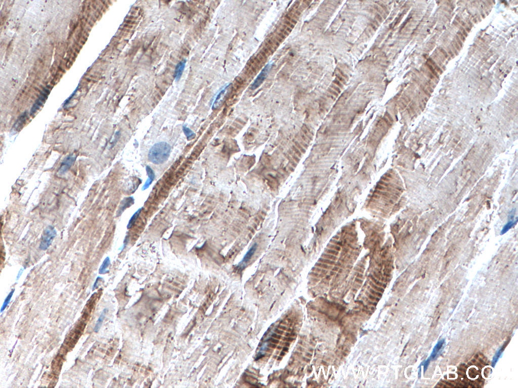 Immunohistochemistry (IHC) staining of mouse skeletal muscle tissue using Alpha Actin Polyclonal antibody (23082-1-AP)