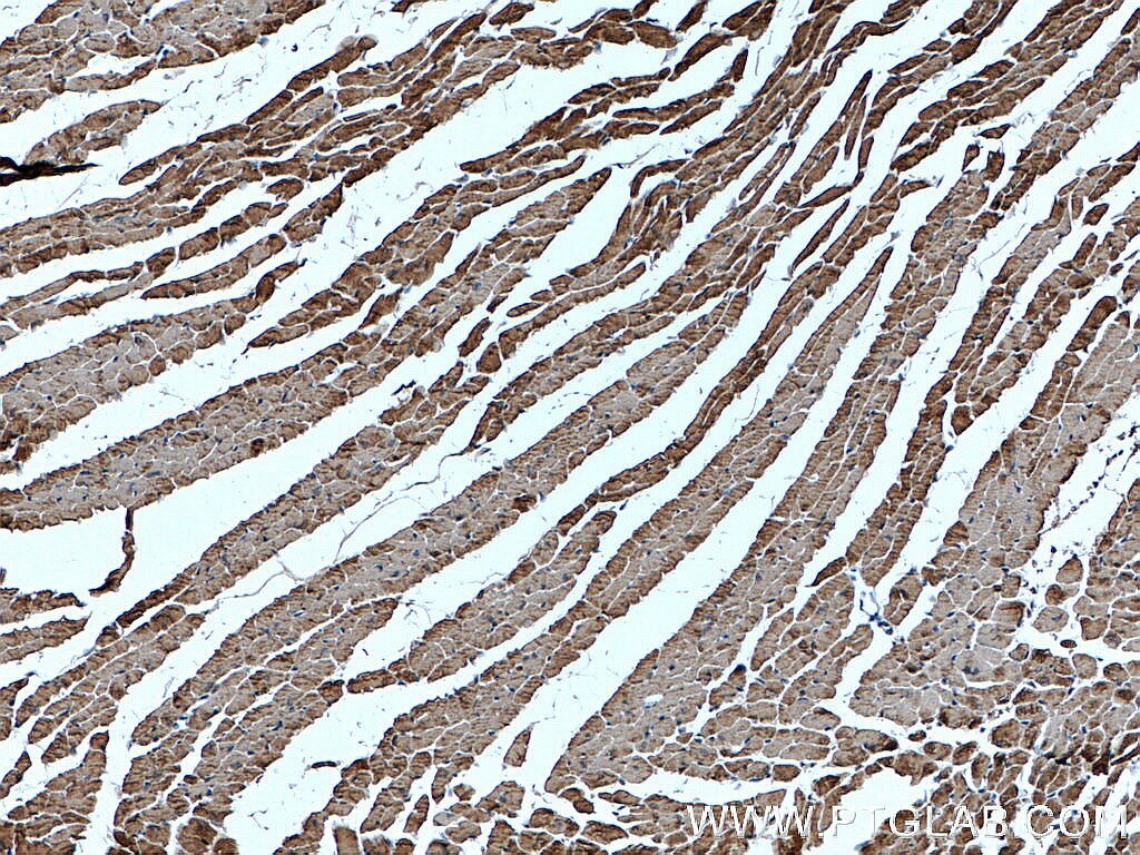 Immunohistochemistry (IHC) staining of mouse heart tissue using Alpha Actin Polyclonal antibody (23082-1-AP)