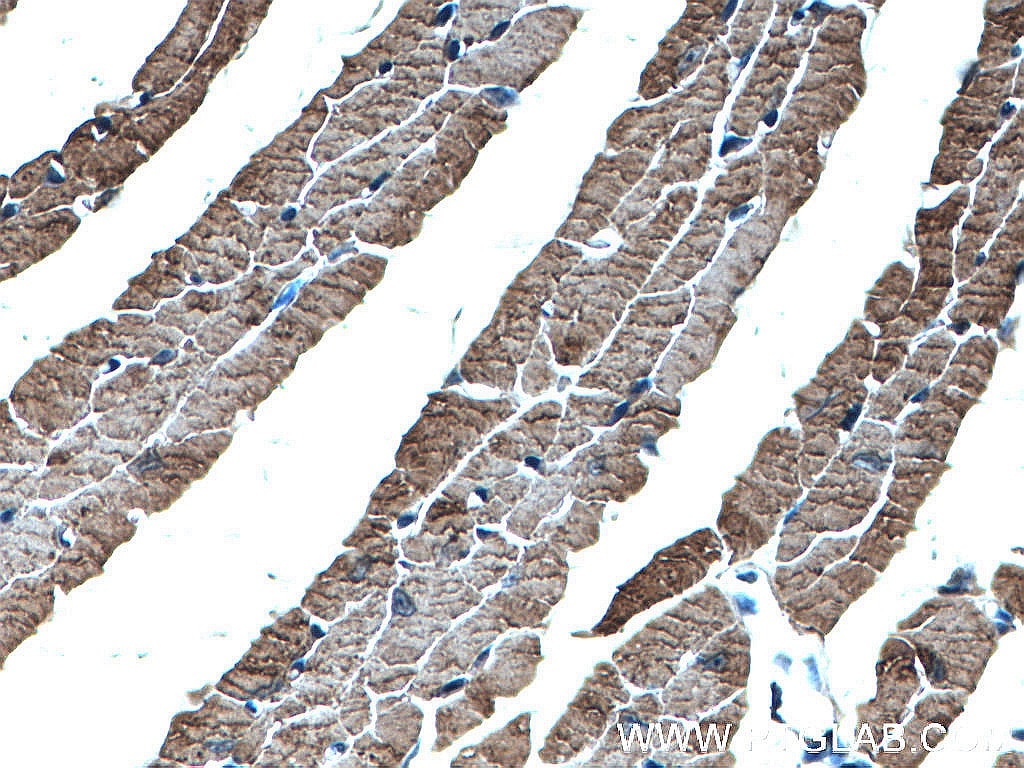 Immunohistochemistry (IHC) staining of mouse heart tissue using Alpha Actin Polyclonal antibody (23082-1-AP)