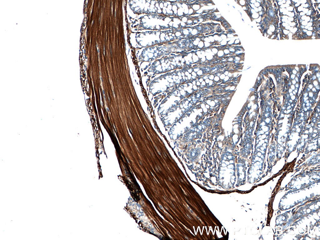 Immunohistochemistry (IHC) staining of mouse colon tissue using Alpha Actin Polyclonal antibody (23082-1-AP)