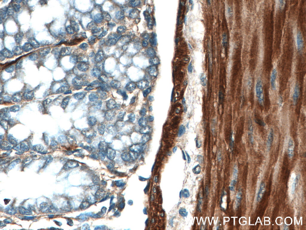Immunohistochemistry (IHC) staining of mouse colon tissue using Alpha Actin Polyclonal antibody (23082-1-AP)