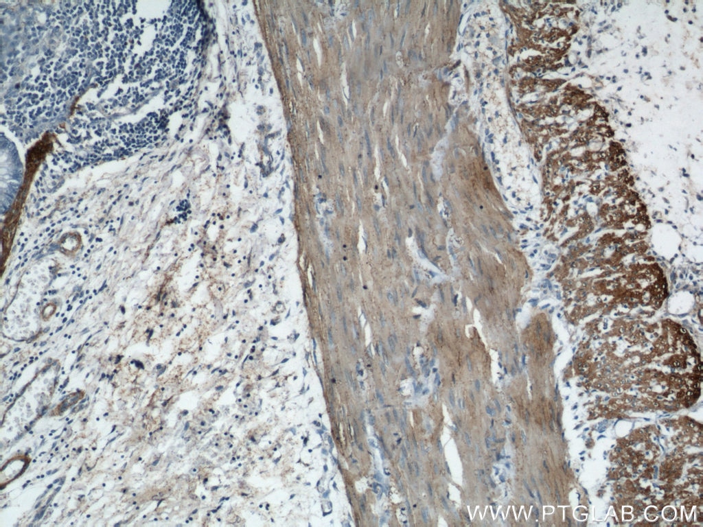 IHC staining of human colon using 23082-1-AP