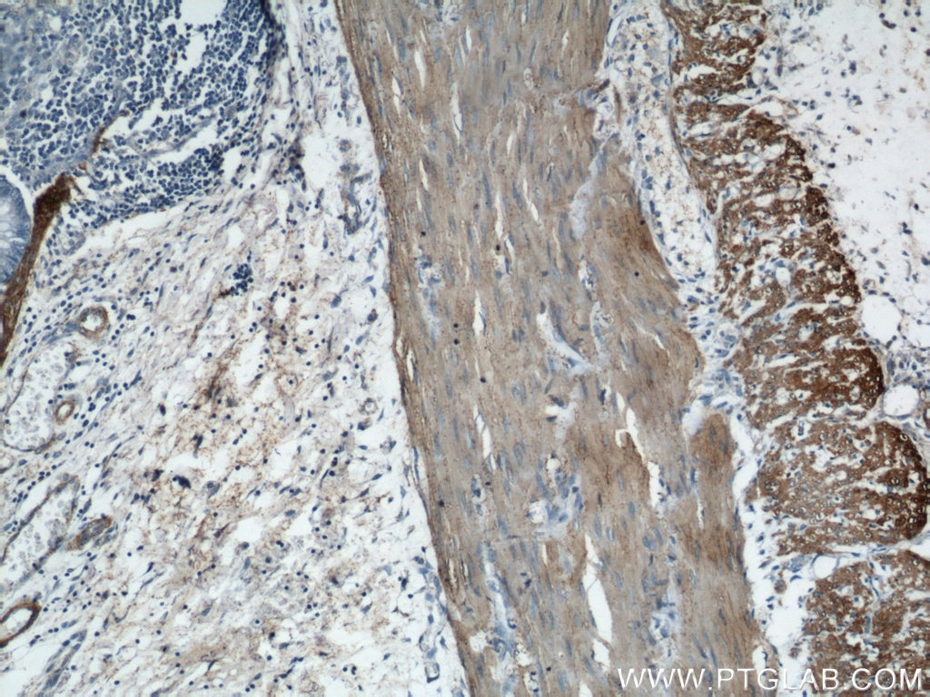 Immunohistochemistry (IHC) staining of human colon tissue using Alpha Actin Polyclonal antibody (23082-1-AP)