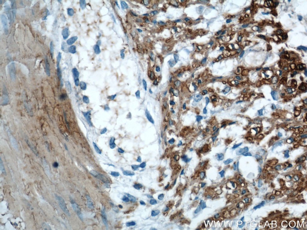 IHC staining of human colon using 23082-1-AP