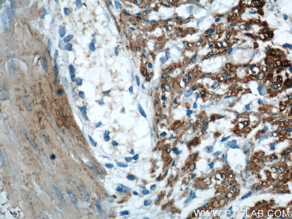 Immunohistochemistry (IHC) staining of human colon tissue using Alpha Actin Polyclonal antibody (23082-1-AP)