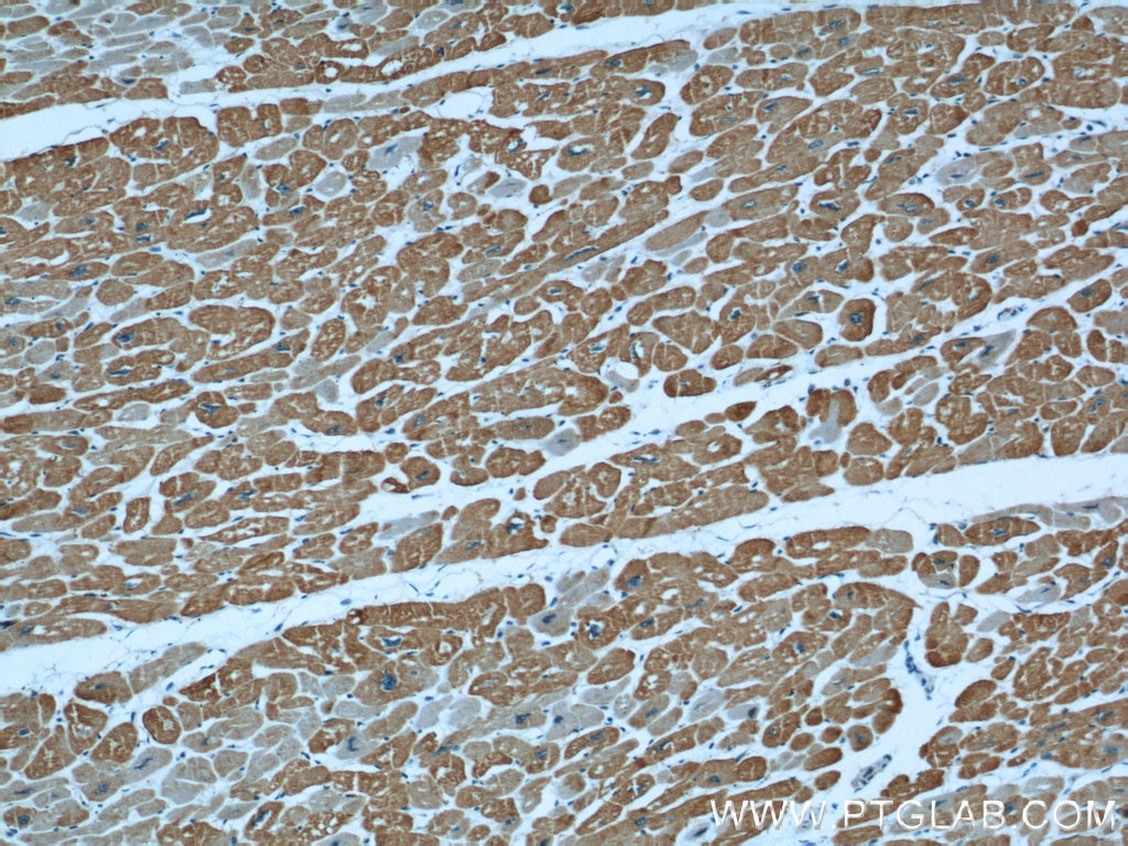 Immunohistochemistry (IHC) staining of human heart tissue using Alpha Actin Polyclonal antibody (23082-1-AP)