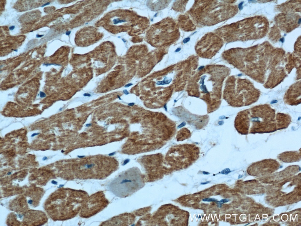 Immunohistochemistry (IHC) staining of human heart tissue using Alpha Actin Polyclonal antibody (23082-1-AP)