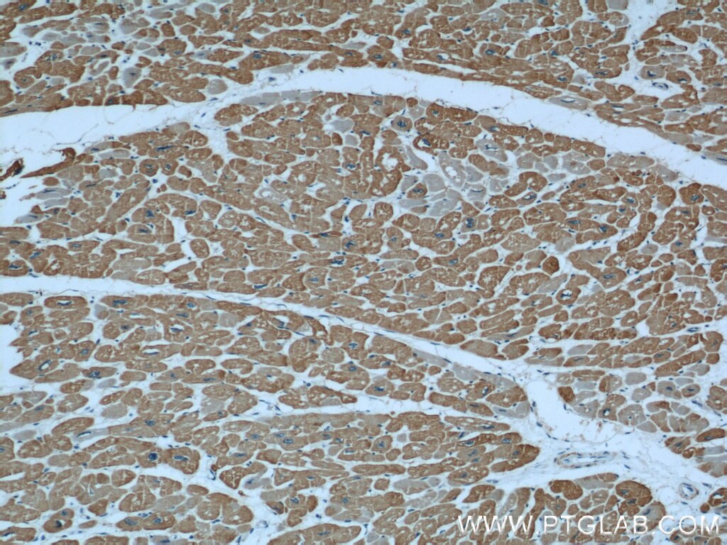 Immunohistochemistry (IHC) staining of human heart tissue using Alpha Actin Polyclonal antibody (23082-1-AP)