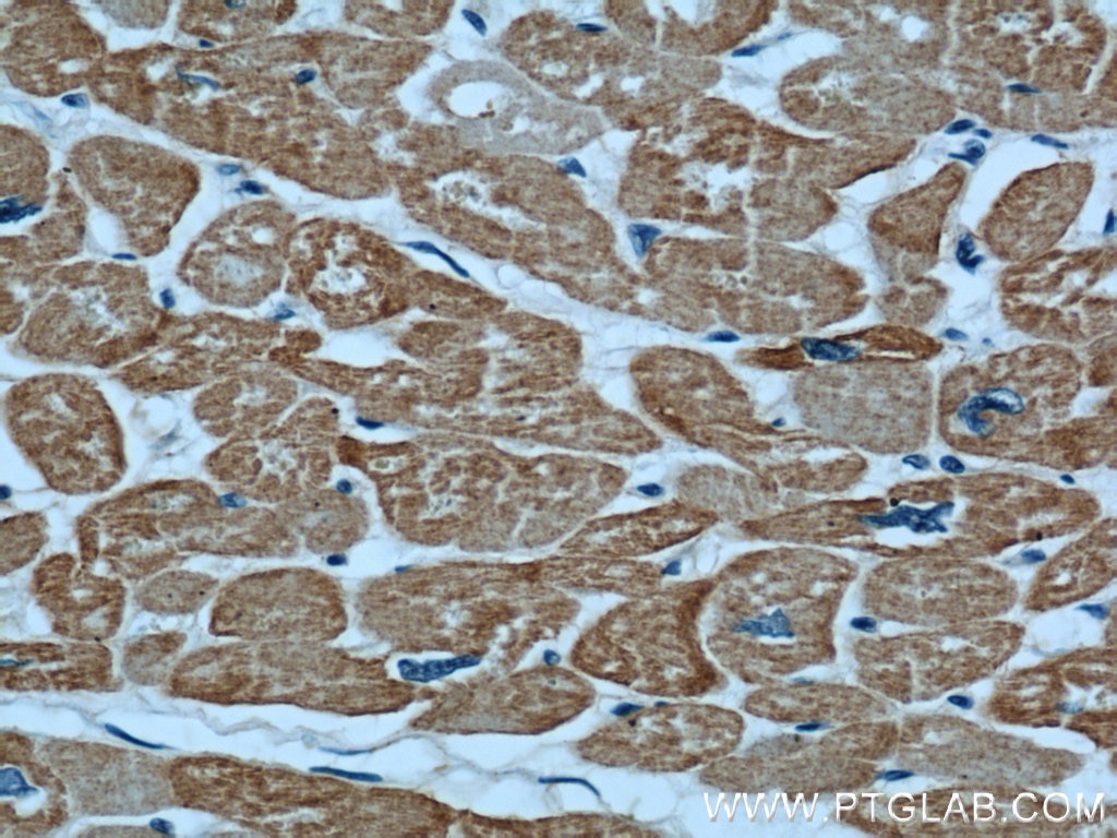 Immunohistochemistry (IHC) staining of human heart tissue using Alpha Actin Polyclonal antibody (23082-1-AP)