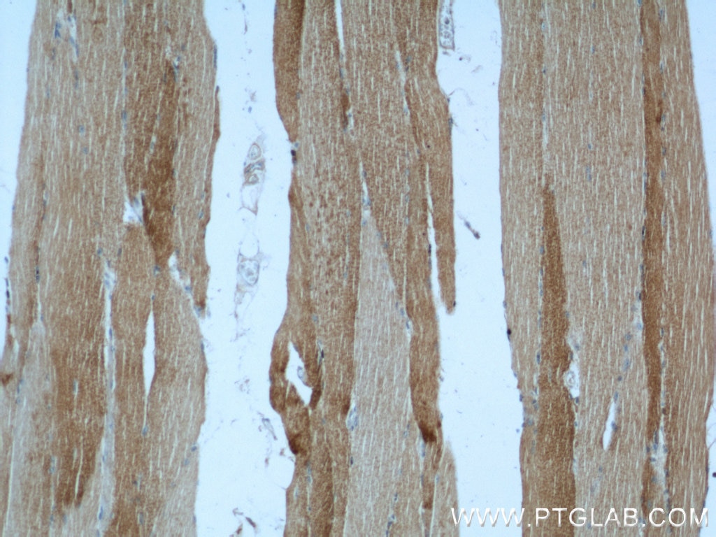IHC staining of human skeletal muscle using 23082-1-AP