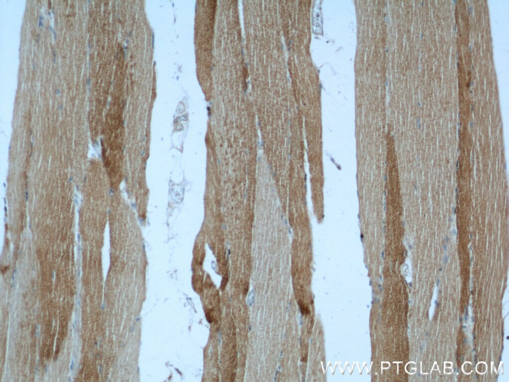 Immunohistochemistry (IHC) staining of human skeletal muscle tissue using Alpha Actin Polyclonal antibody (23082-1-AP)